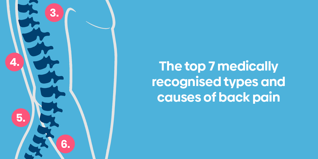 managing backpain